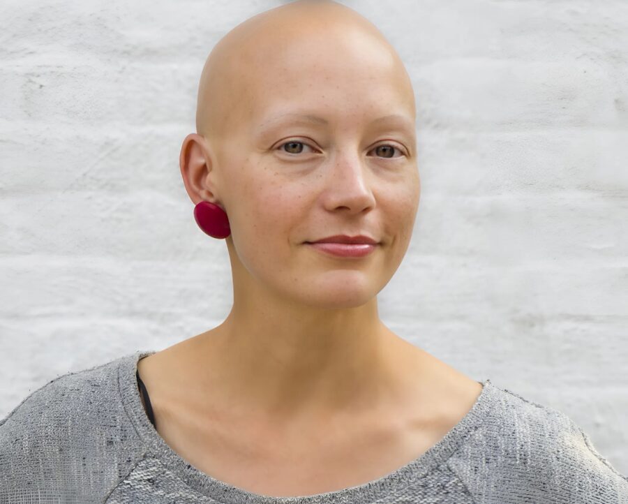 Jag vaknade skallig och förstod direkt att det var min man: det gjorde ont, men jag bestämde mig för att hämnas